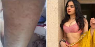 Actress Adah sharma in hospital