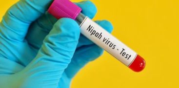 nipah virus test