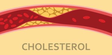 Cholesterol can be controlled, simply