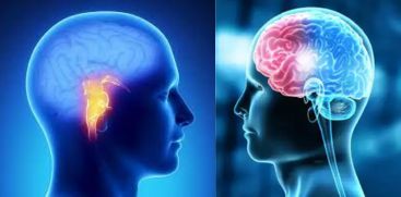 Unhealthy lifestyles and increasing Brain Stroke among young adults