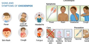 Chickenpox is rampant in the state