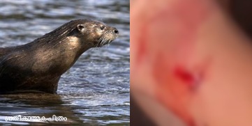 Children attacked by Otter at Kozhikode