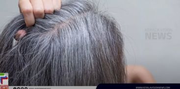 Let's see the cause and solution of premature graying.