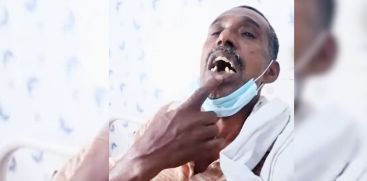 Man accuses police for the loss of his teeth