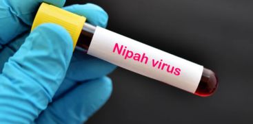  Nipah test